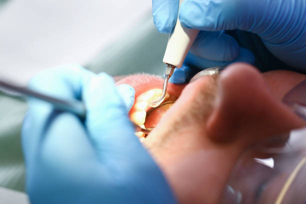 Best Cosmetic Emergency Dentistry in Queen Anne, MD