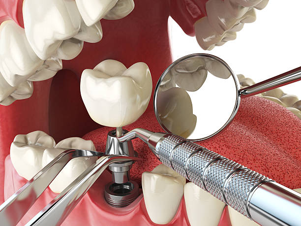 Best Emergency TMJ Treatment in Queen Anne, MD